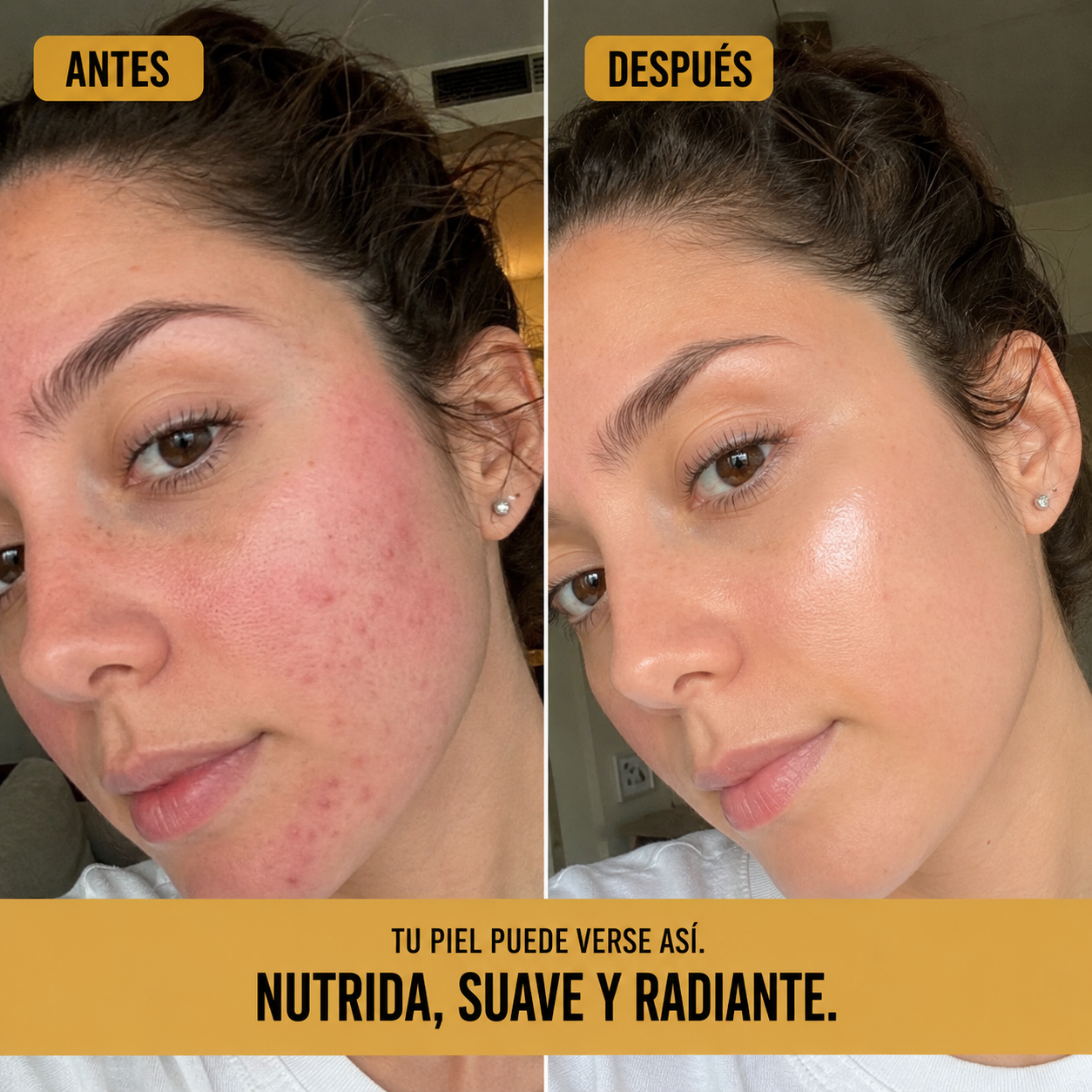 SOS Piel™ | Bálsamo Reparador Intensivo